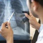 tabagismo cresce entre jovens brasileiros e acende alert 1788113479896