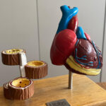 colesterol alto o acumulo de gordura nas arterias pode c 1788631169670